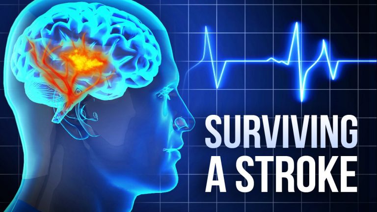 MENGENALI STROKE